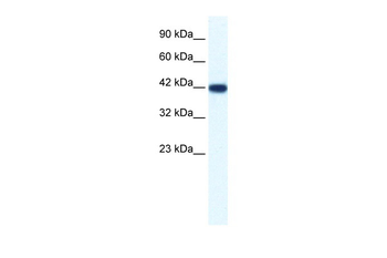 IBSP Rabbit Polyclonal Antibody