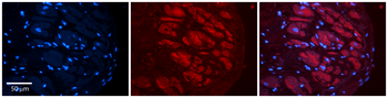 ADAR Rabbit Polyclonal Antibody