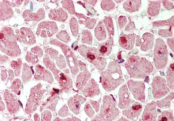 Mxi1 Rabbit Polyclonal Antibody