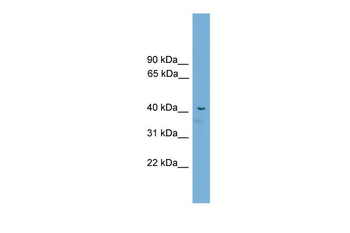 Acd Rabbit Polyclonal Antibody