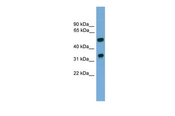 Foxa3 Rabbit Polyclonal Antibody