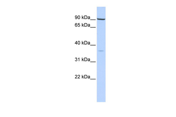 Nkx2-5 Rabbit Polyclonal Antibody