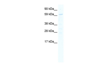 STAT1 Rabbit Polyclonal Antibody