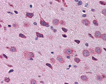 Tbr1 Rabbit Polyclonal Antibody