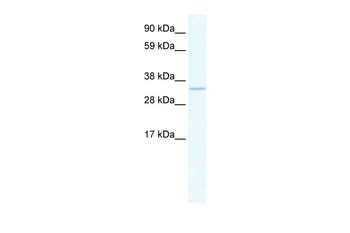 APEX1 Rabbit Polyclonal Antibody