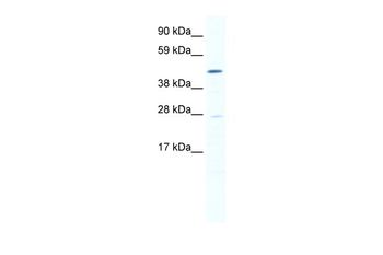 SMYD1 Rabbit Polyclonal Antibody