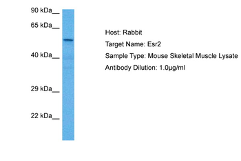 Esr2 Rabbit Polyclonal Antibody