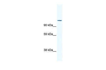 NFATC2 Rabbit Polyclonal Antibody
