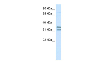NKX2-2 Rabbit Polyclonal Antibody