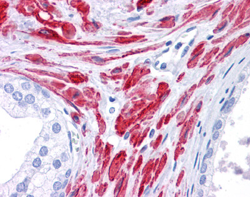 STAT5B Rabbit Polyclonal Antibody