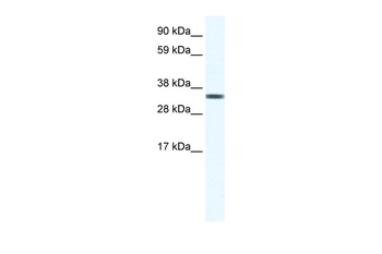 TCEA1 Rabbit Polyclonal Antibody