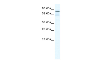 PARN Rabbit Polyclonal Antibody