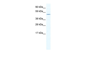 NR5A1 Rabbit Polyclonal Antibody