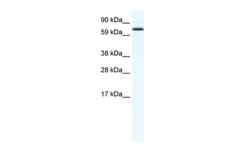 FOXO6 Rabbit Polyclonal Antibody