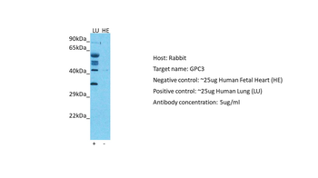 GPC3 Rabbit Polyclonal Antibody