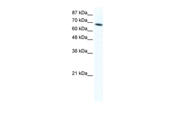 DDX1 Rabbit Polyclonal Antibody