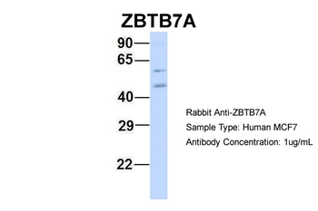 ZBTB7A Rabbit Polyclonal Antibody
