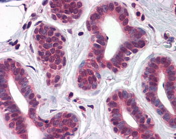TBX18 Rabbit Polyclonal Antibody