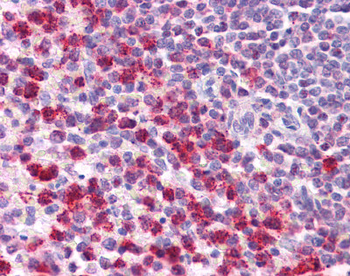 TGFB1 Rabbit Polyclonal Antibody