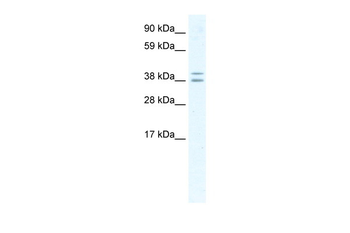 TSG101 Rabbit Polyclonal Antibody