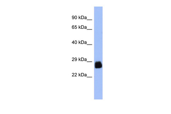 PDX1 Rabbit Polyclonal Antibody