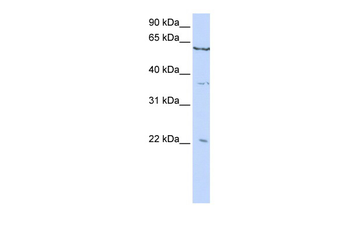 CSRP2 Rabbit Polyclonal Antibody