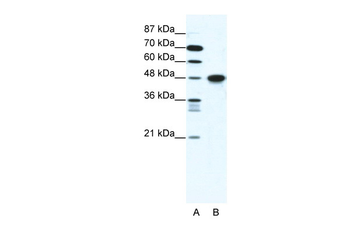 ENO1 Rabbit Polyclonal Antibody