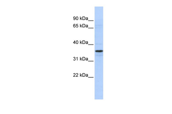 TADA2L Rabbit Polyclonal Antibody