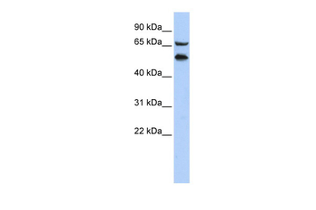 TADA2L Rabbit Polyclonal Antibody