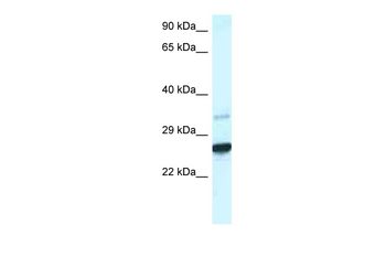 Cdx1 Rabbit Polyclonal Antibody