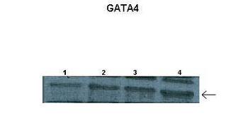 GATA4 Rabbit Polyclonal Antibody