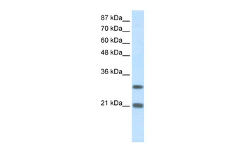MSX2 Rabbit Polyclonal Antibody