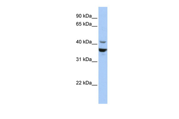 NEUROD1 Rabbit Polyclonal Antibody