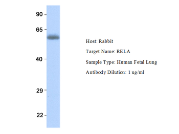 RELB Rabbit Polyclonal Antibody