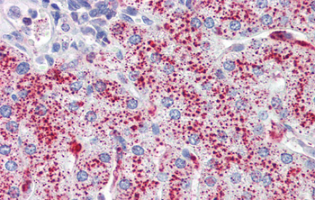 SP4 Rabbit Polyclonal Antibody