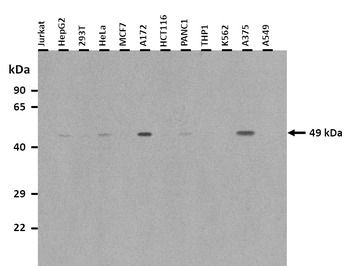 TEAD3 Rabbit Polyclonal Antibody