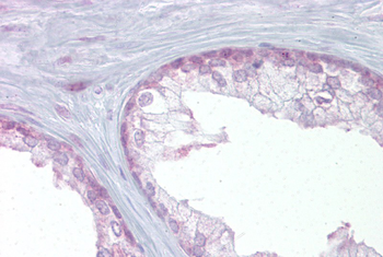 EDF1 Rabbit Polyclonal Antibody