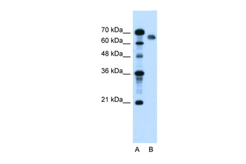 NR5A2 Rabbit Polyclonal Antibody
