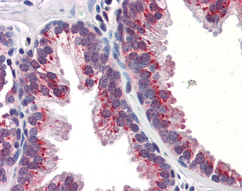 KLF4 Rabbit Polyclonal Antibody