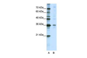 CRSP8 Rabbit Polyclonal Antibody