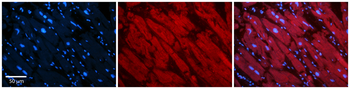 ASPH Rabbit Polyclonal Antibody