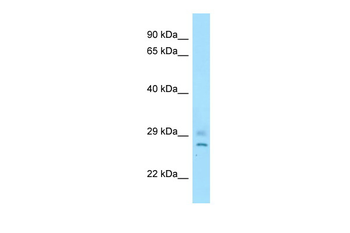 Cnot8 Rabbit Polyclonal Antibody