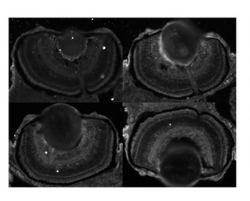 CDK5 Rabbit Polyclonal Antibody
