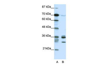 CDK5 Rabbit Polyclonal Antibody