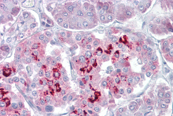 SIM1 Rabbit Polyclonal Antibody