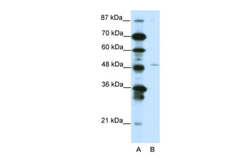 MEOX2 Rabbit Polyclonal Antibody