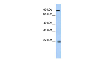 NFATC1 Rabbit Polyclonal Antibody