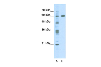 PDLIM5 Rabbit Polyclonal Antibody
