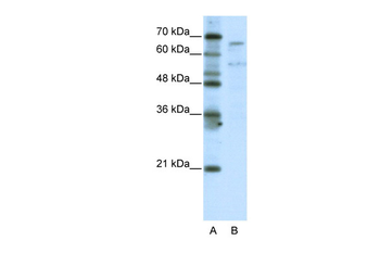 TAF6L Rabbit Polyclonal Antibody