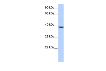 HOXA2 Rabbit Polyclonal Antibody